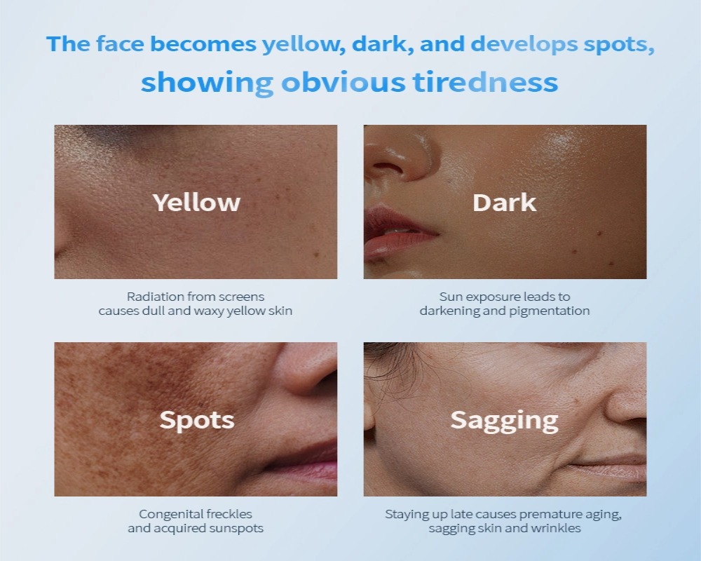 vitamin c serum before after brightening vitamin c serum before after brightening