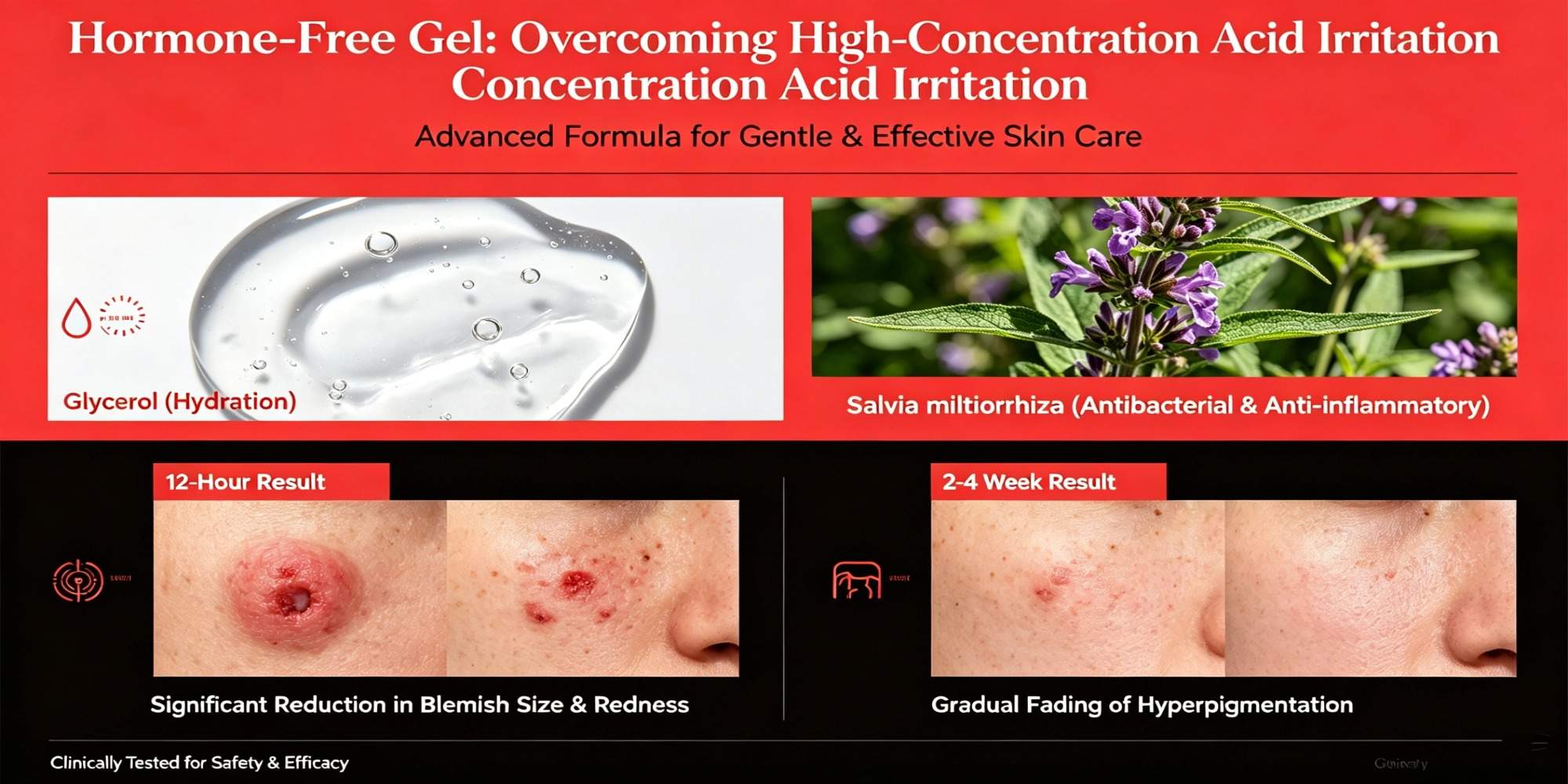 Private label acne gel